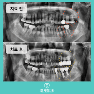 천호동치과잘하는곳