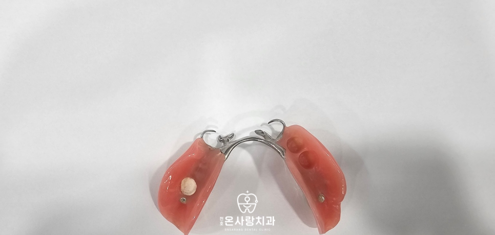 성내동치과