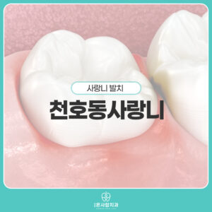 천호동사랑니