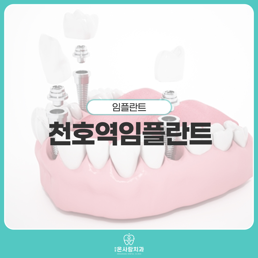 천호역임플란트