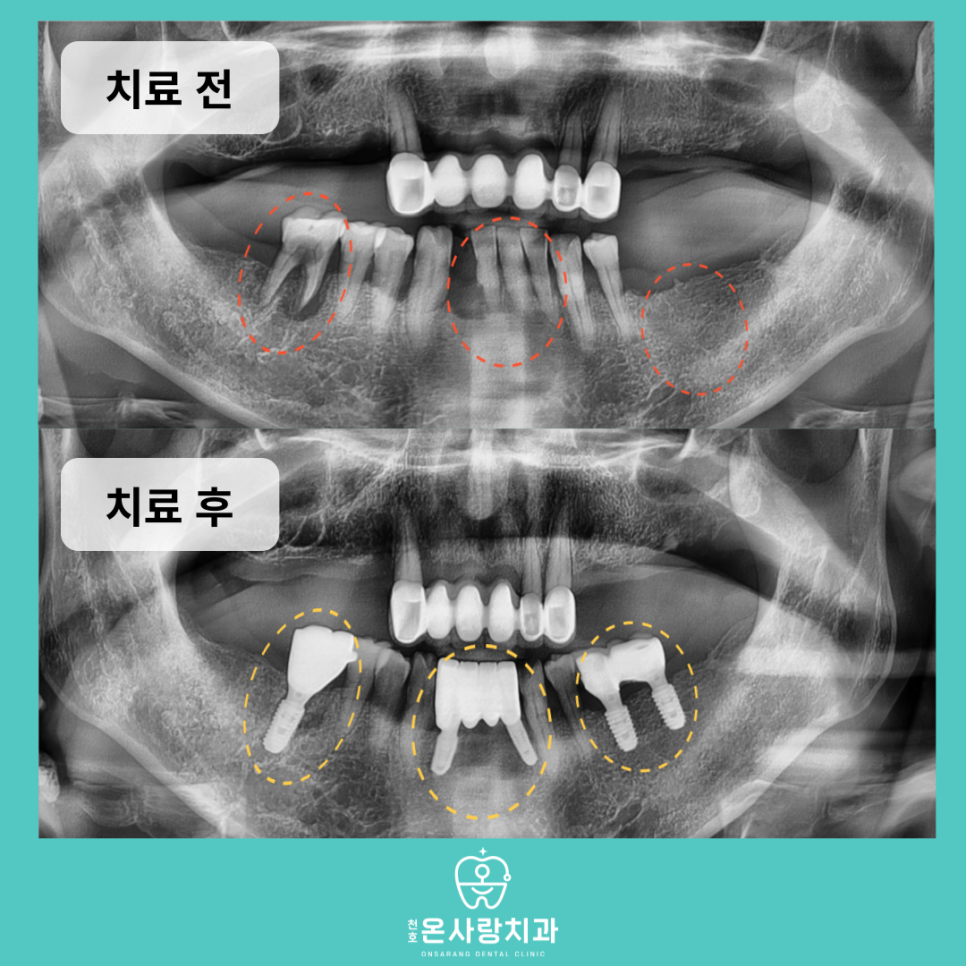 성내동치과잘하는곳 