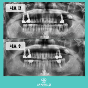 천호동치과