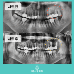 천호역치과