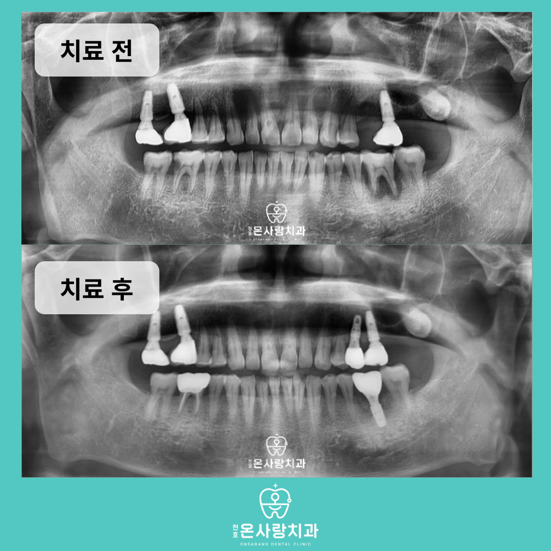 천호동치과