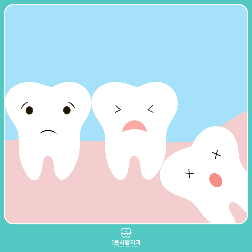 사랑니 누워있는 사진