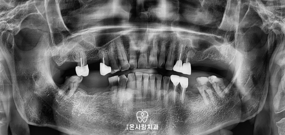 천호동치과