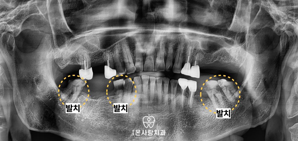 천호동치과