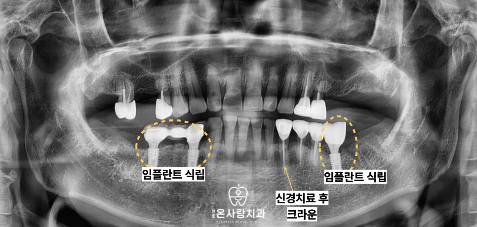 천호동치과