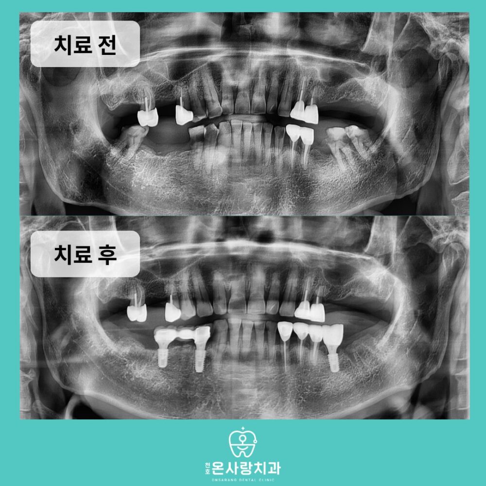 천호동치과