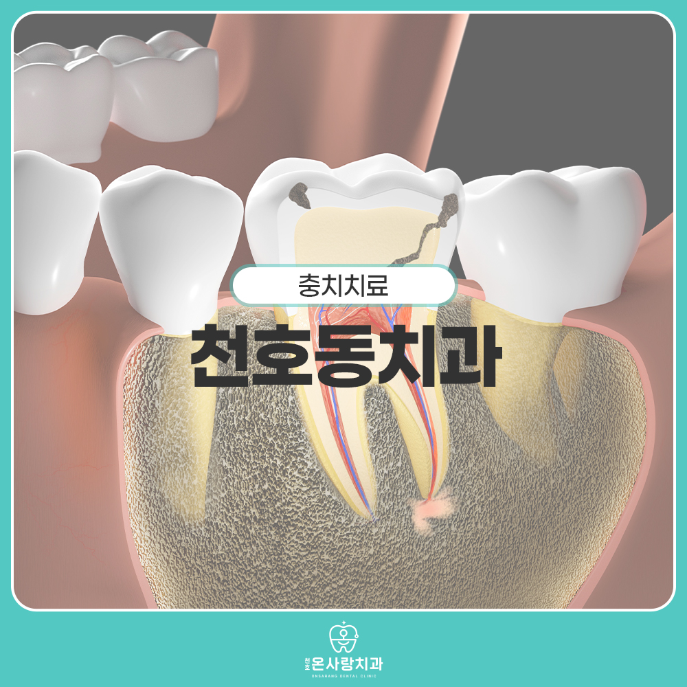 천호동치과