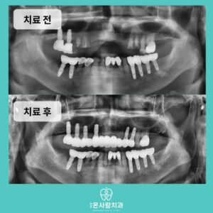 천호동친절한치과