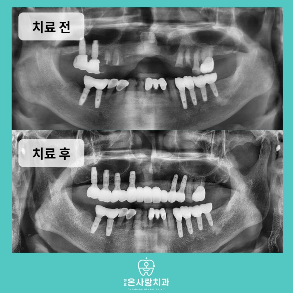 천호동친절한치과