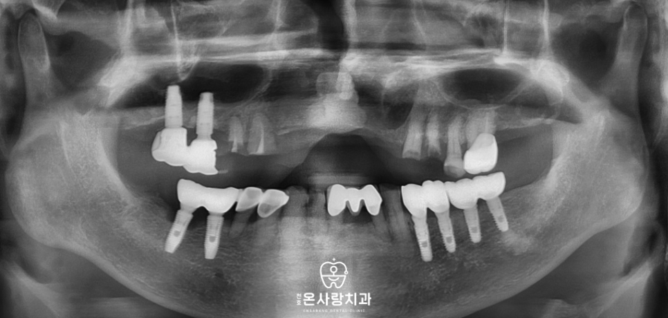 천호동친절한치과