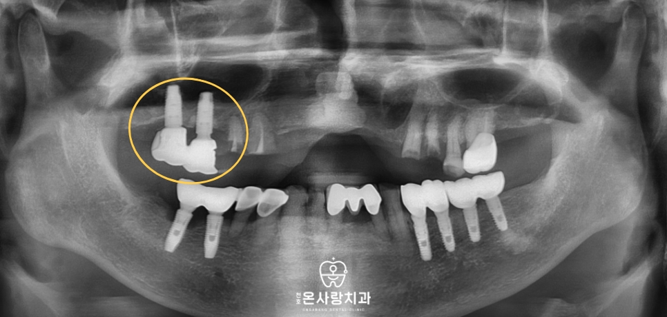 천호동친절한치과
