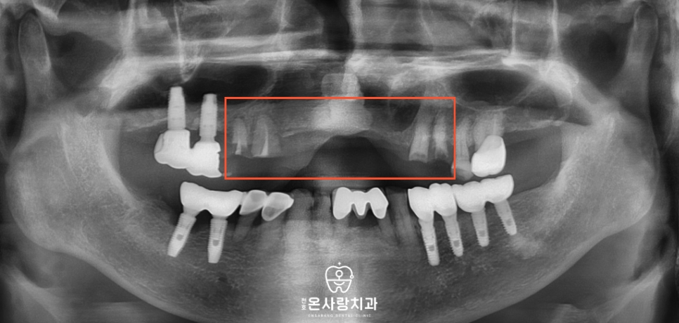 천호동친절한치과