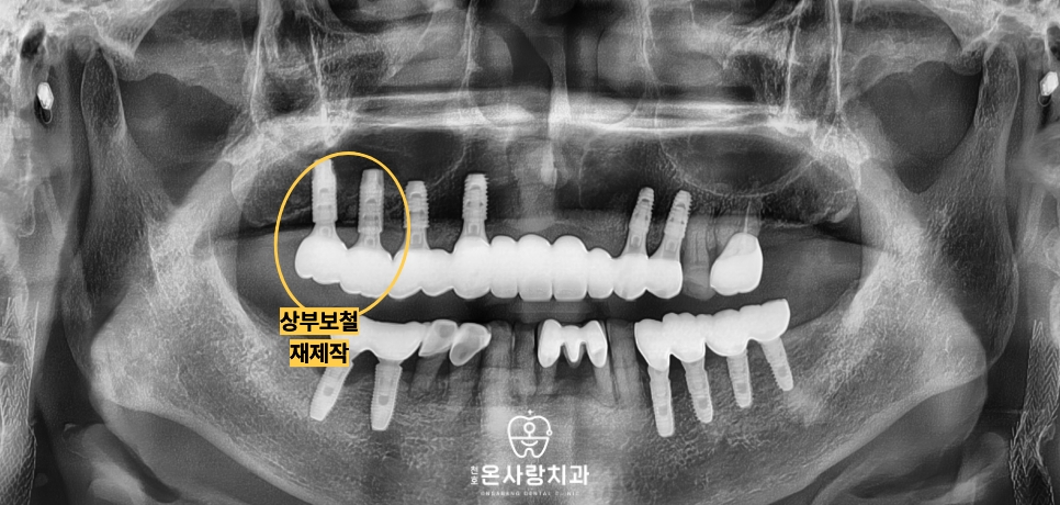 천호동친절한치과