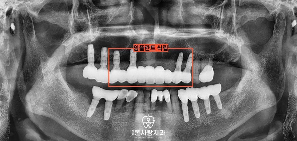 천호동친절한치과